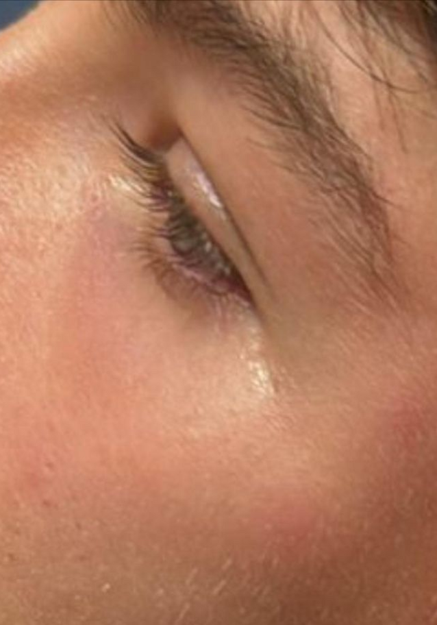 Ancora violenze sui giovani arbitri: aggredito 15enne durante una partita U16