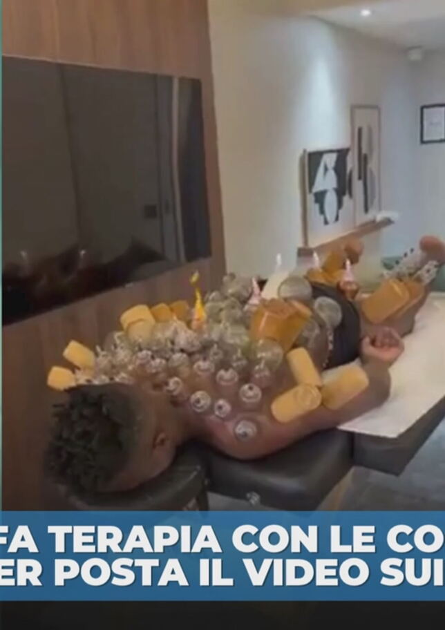 Onana e la strana terapia delle coppette