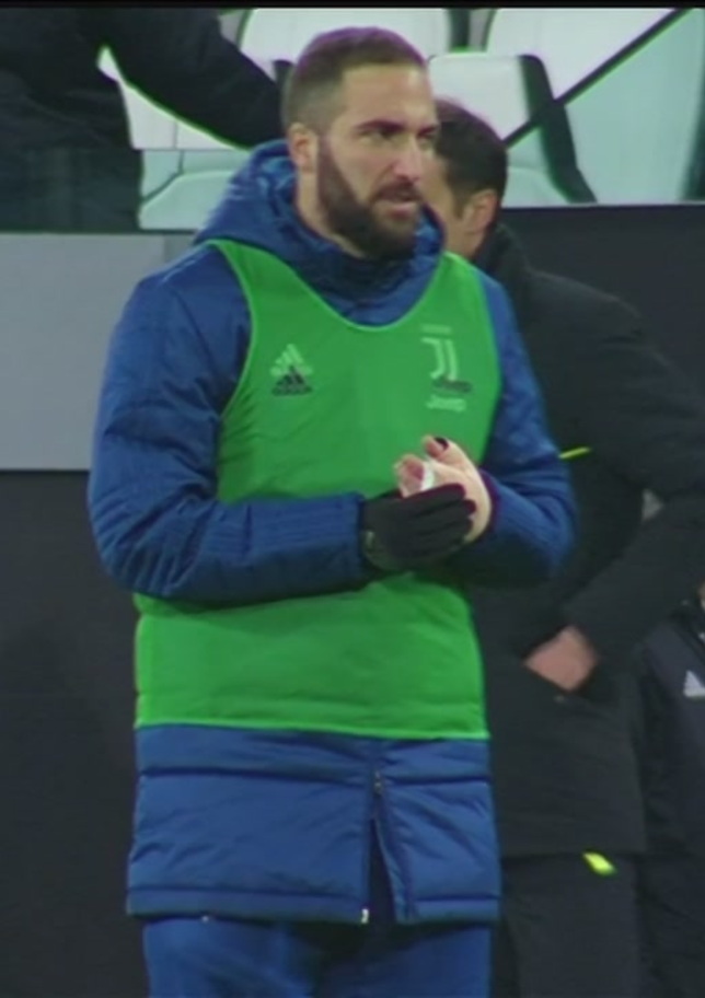 Higuain, operazione riuscita